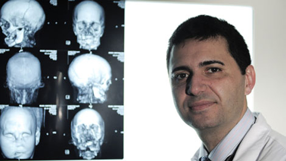 أطباء إسبانيا يجرون أول عملية لزرع وجه كامل في العالم  صورة رقم 1