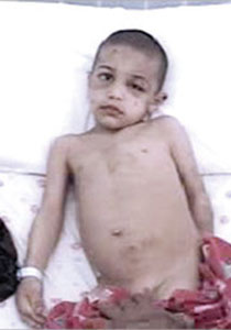 لبنان: طفل تبول لا ارادياً فعذبه زوج امه وربط عضوه الذكري صورة رقم 1