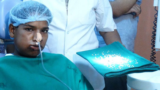 اطباء يقتلعون 232 سنا من فم شاب هندي يبلغ 17 عاما صورة رقم 1