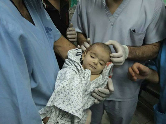 وسط تصاعد القصف المتبادل.. عدد القتلى والمصابين الفلسطينيين يرتفع الى 8355  صورة رقم 3
