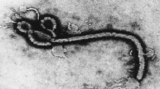 فيروس ايبولا مصدره طفل افريقي توفيت امه واخته بعده! صورة رقم 4