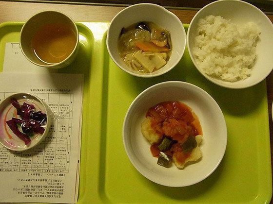 صور وجبات المرضى في المستشفيات حول العالم.. اليابان اسماك وخضار والإمارات سباجيتي ولحم وجاتوه صورة رقم 16