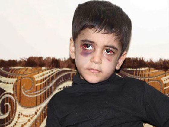 طفل عراقي معنّف يطلب من الشرطة اعدام والده وزوجته صورة رقم 1