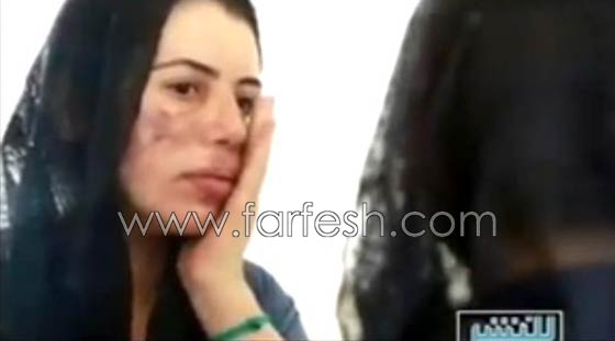 فيديو غريب وصادم: عمليات التجميل تدمر حياة لبنانية ارادت التشبه بنانسي وهيفا صورة رقم 4