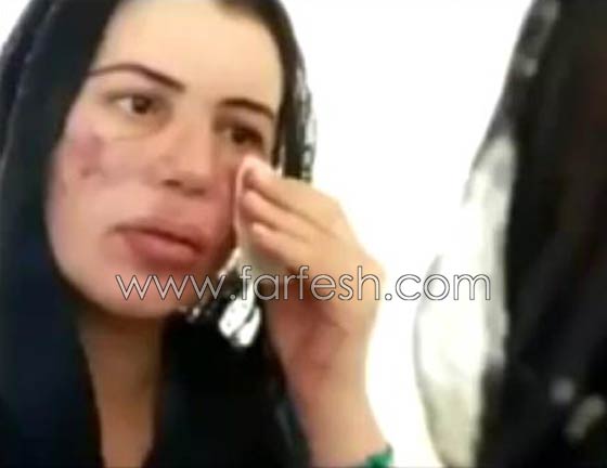 فيديو غريب وصادم: عمليات التجميل تدمر حياة لبنانية ارادت التشبه بنانسي وهيفا صورة رقم 1