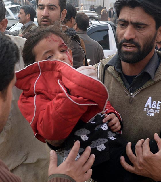 بالصور.. شاهد بشاعة ما احدثه هجوم طالبان على المدرسة الباكستانية صورة رقم 11