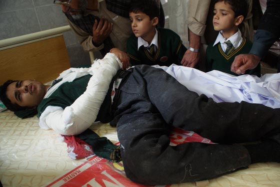 بالصور.. شاهد بشاعة ما احدثه هجوم طالبان على المدرسة الباكستانية صورة رقم 17