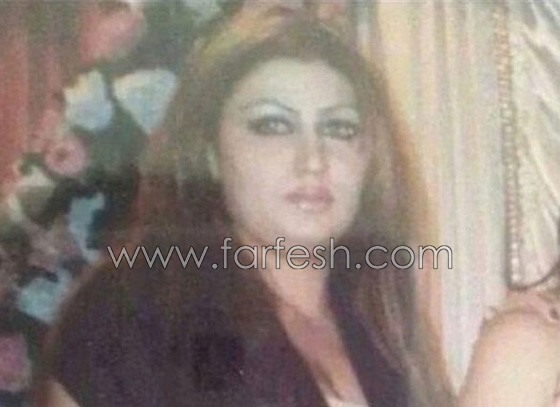 صور صادمة للفنانة السورية هبة نور قبل عمليات التجميل صورة رقم 1