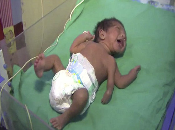 صور وفيديو طفل هندي وُلد مع ثلاث أذرع  صورة رقم 1