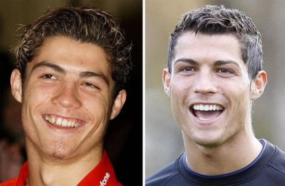صور مشاهير كرة القدم قبل وبعد عمليات التجميل صورة رقم 4