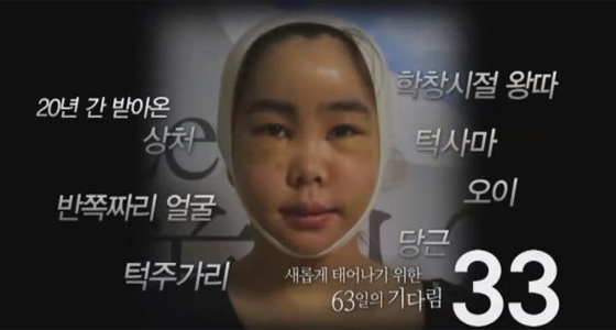 بالفيديو.. شاهد كيف تحولت كورية بشعة جدا الى ملكة جمال صورة رقم 5