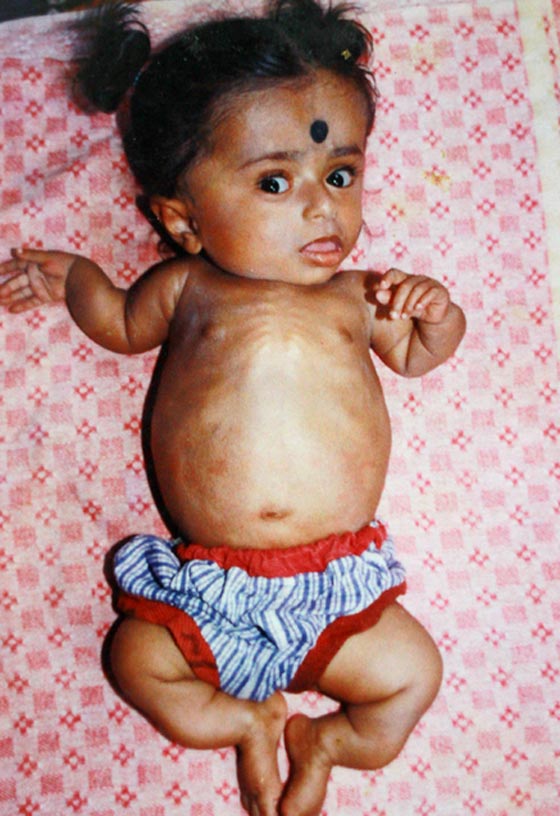 صور فنانة هندية  مبدعة عمرها  19 عاما، مسجونة في جسد طفلة صورة رقم 7