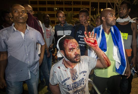 تل ابيب تشتعل وصدامات عنيفة بين الشرطة والاثيوبيين صورة رقم 20