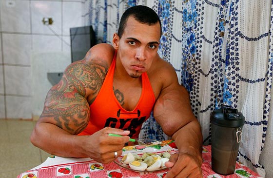 فيديو وصور برازيلي يحقن عضلاته بالزيت والكحول ويعرّض ذراعيه لخطر البتر صورة رقم 4