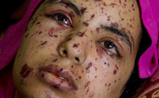 صور تحبس الانفاس بعدسة مصورة امريكية شجاعة في حرب غزة صورة رقم 7