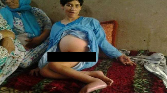 قصة شابة معاقة تتعرض للاغتصاب والحمل من مجهول تهز المغرب صورة رقم 1