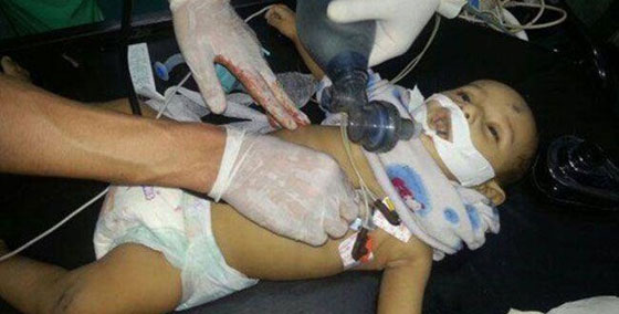 وزير الصحة الفلسطيني: الحالة الصحية لافراد عائلة دوابشة حرجة صورة رقم 2