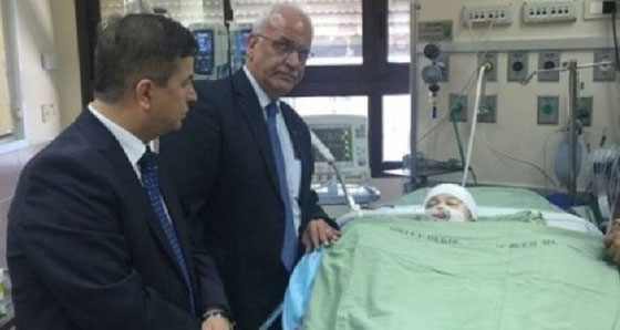 وزير الصحة الفلسطيني: الحالة الصحية لافراد عائلة دوابشة حرجة صورة رقم 1