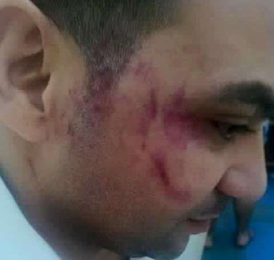 الاردن يهتز..عامل مصري يتعرض لاعتداء من اشقاء نائب بحمايته صورة رقم 2