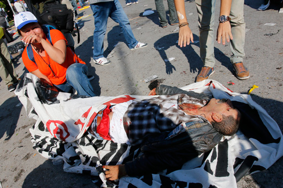 قتلى وجرحى في انفجار وسط مظاهرة للسلام في انقرة التركية صورة رقم 1
