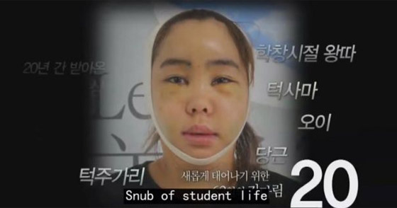  عمليات التجميل في كوريا تحوّل ابشع الفتيات الى ملكات جمال: فيديو قبل وبعد! صورة رقم 2