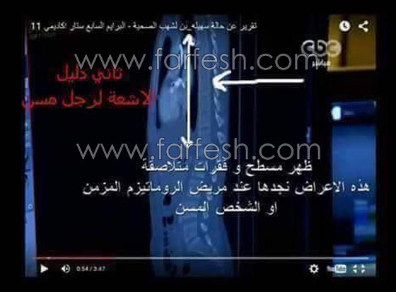  جمهور ستار اكاديمي 11 ينشر صور وفيديو سقوط سهيلة بن لشهب ويثبت انه مفبرك! صورة رقم 5