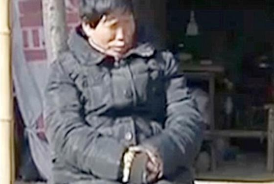 فيديو وصور امرأة صينية تذرف حجارة كبيرة من عينيها بدل الدموع صورة رقم 4