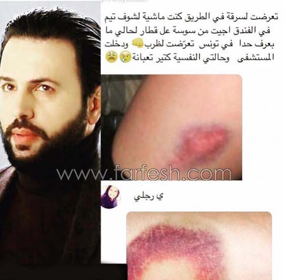 صور: بلطجية يعتدون على فتاة تونسية بالضرب بسبب تيم حسن! صورة رقم 1