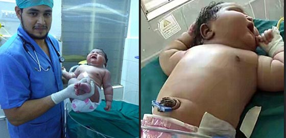 المولودة الاثقل في العالم.. مفاجأة هندية جديدة صورة رقم 1