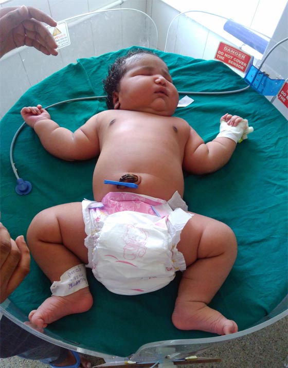 المولودة الاثقل في العالم.. مفاجأة هندية جديدة صورة رقم 3