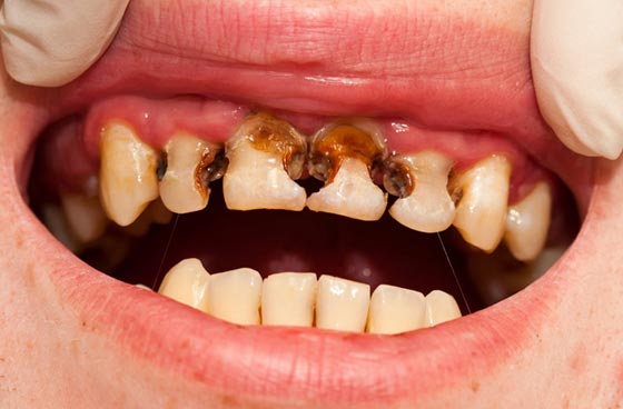 مثلث الموت منطقة حساسة وخطرة للغاية وموقعها بين الفم والانف صورة رقم 5