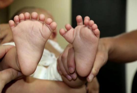 حالة نادرة.. ولادة طفل صيني بـ 31 اصبعا صورة رقم 2