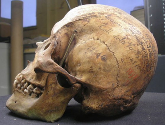 18 ألف جمجمة بمتحف باريس لجزائريين قطع رؤوسهم الاستعمار  صورة رقم 6