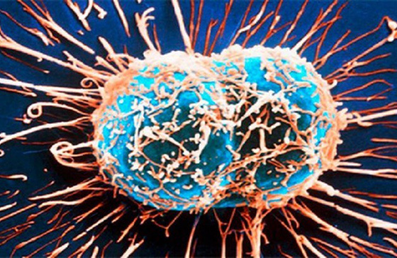 هل يحل علماء الرياضيات سر تكاثر الخلايا السرطانية؟ صورة رقم 2
