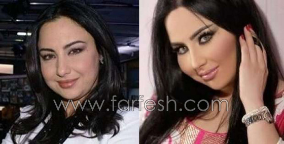  صور قبل وبعد عمليات التجميل لـ 7 مذيعات عربيات: الفرق كبير! صورة رقم 7
