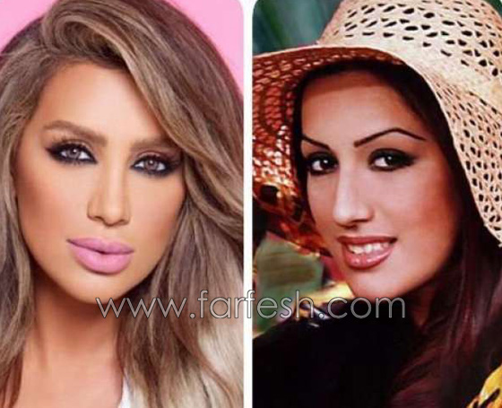  صور قبل وبعد عمليات التجميل لـ 7 مذيعات عربيات: الفرق كبير! صورة رقم 5