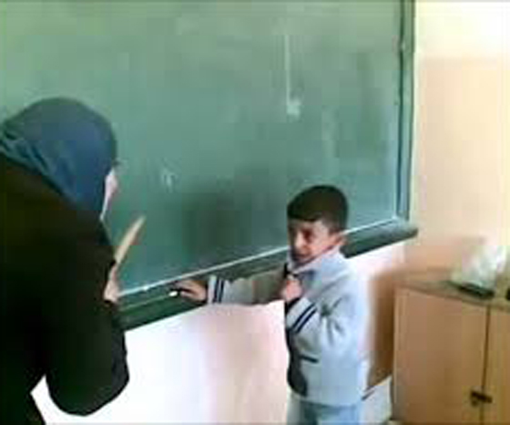  التحقيق مع معلمة مصرية تسببت فى قطع شرايين يد احد طلابها! صورة رقم 3