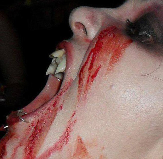 مصاصة دماء حقيقية من استراليا: بدأت شرب الدم وعمرها 12 سنة  صورة رقم 6