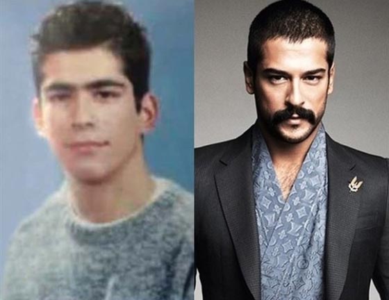 شاهد التحول الذي طرأ على نجوم الدراما التركية قبل وبعد الشهرة.. صور صورة رقم 3