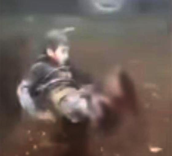 فيديو مروع.. طفل سوري مبتور الساقين ينادي باكيا (بابا شيلني) صورة رقم 1