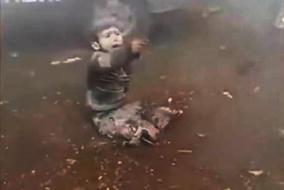 فيديو مروع.. طفل سوري مبتور الساقين ينادي باكيا (بابا شيلني) صورة رقم 3