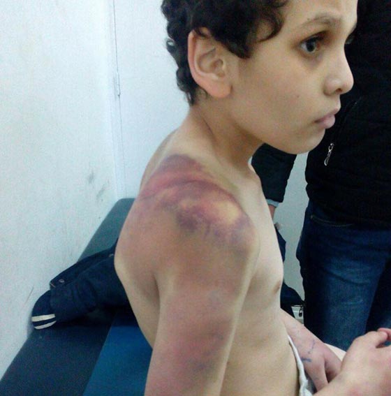 مصرية تشوه جسد ابن زوجها بالضرب والتعذيب حتى اغمي عليه بالمدرسة صورة رقم 1