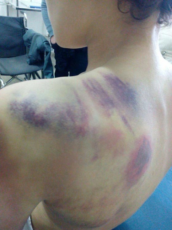 مصرية تشوه جسد ابن زوجها بالضرب والتعذيب حتى اغمي عليه بالمدرسة صورة رقم 2