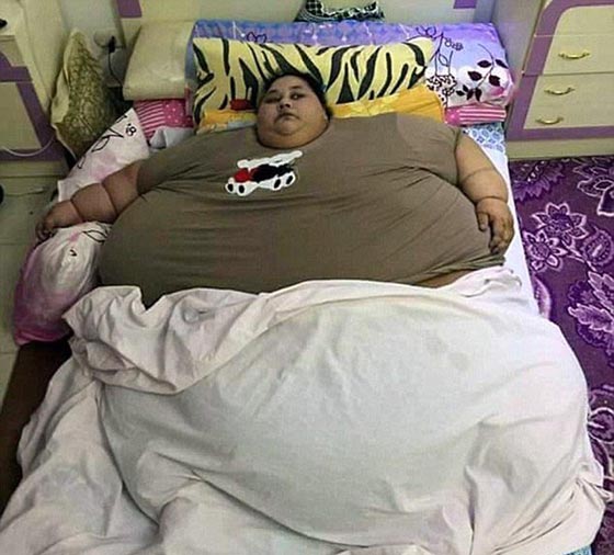 بعد 5 أيام فقط في مستشفى مومباي.. كم فقدت إيمان أحمد من وزنها؟ صور صورة رقم 9