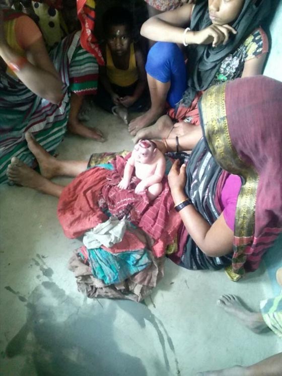 صور غريبة: مولود هندي يشبه كائن فضائي يصدم أمه وأهل القرية! صورة رقم 1