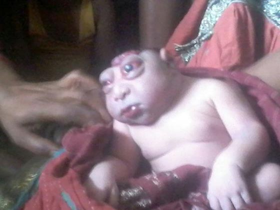 صور غريبة: مولود هندي يشبه كائن فضائي يصدم أمه وأهل القرية! صورة رقم 2
