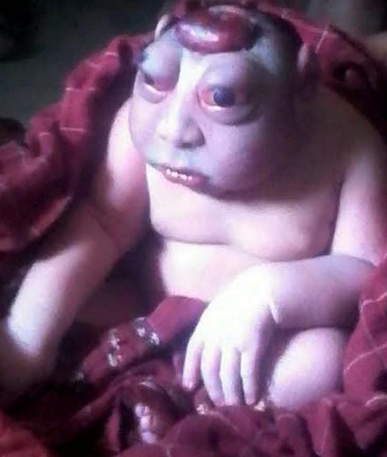 صور غريبة: مولود هندي يشبه كائن فضائي يصدم أمه وأهل القرية! صورة رقم 3