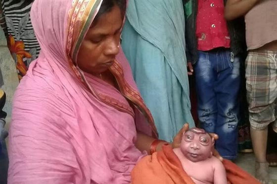 صور غريبة: مولود هندي يشبه كائن فضائي يصدم أمه وأهل القرية! صورة رقم 4