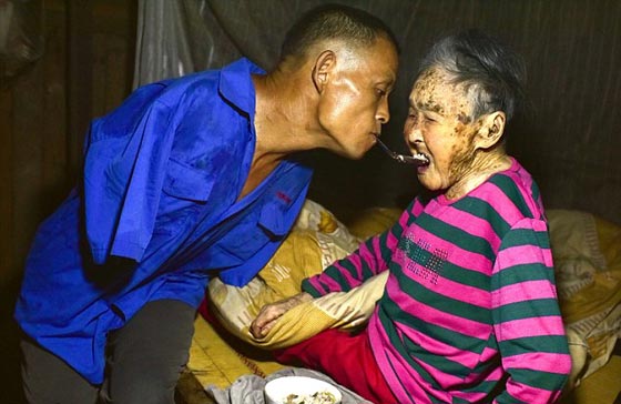 صورة ادهشت الملايين.. مبتور الذراعين يطعم والدته المريضة بفمه صورة رقم 1