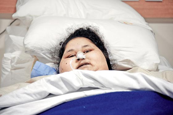 فيديو جديد: ايمان احمد المصرية اثقل امرأة في العالم تتعافى بعد ان خسرت نصف وزنها صورة رقم 2